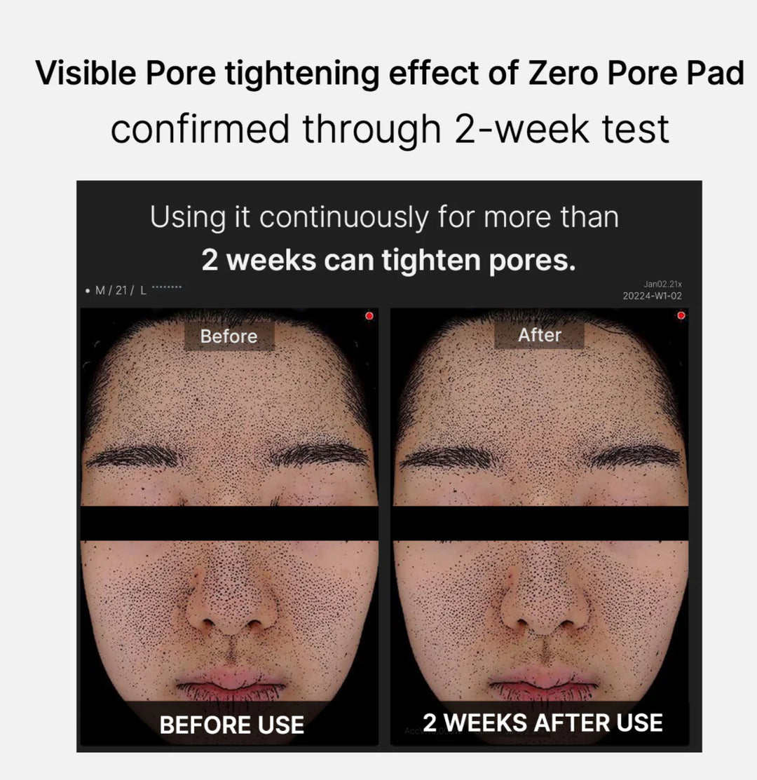 Zero pore pad