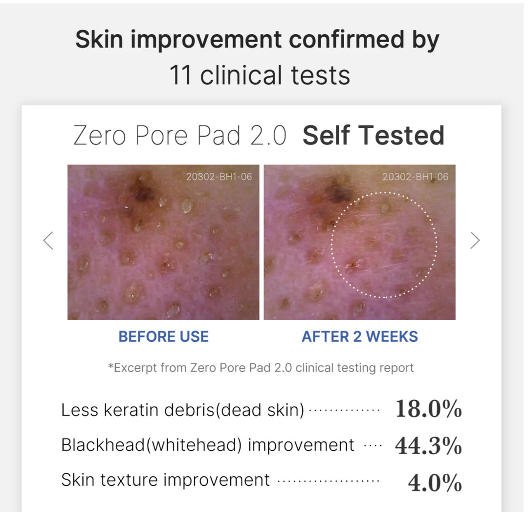 Zero pore pad