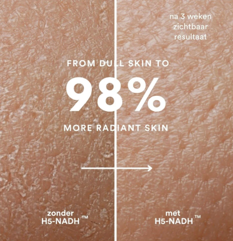 Insentials Inner Beauty H5-NADH – Skin Longevity & Hydratatie van Binnenuit