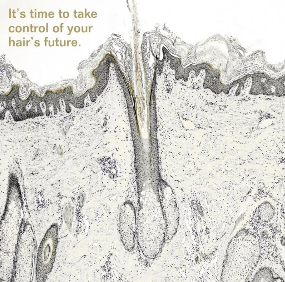 Insentials Hair Strength+ – Anti-Haaruitval & Sterkere Haargroei