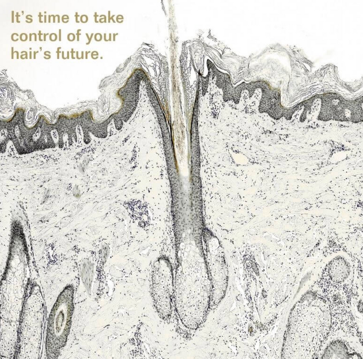 Insentials Hair Strength+ – Anti-Haaruitval & Sterkere Haargroei