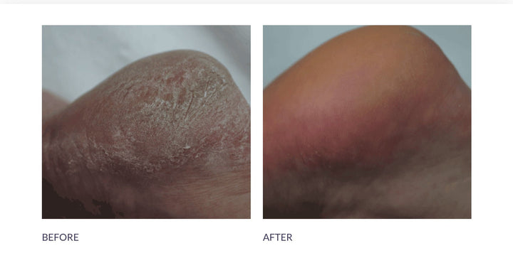 Footlogix DD Cream mousse 125ml - Droge of rijpere huid - Blossoms Beauty