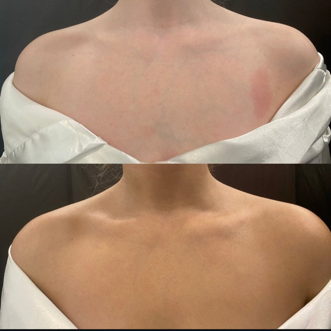 Spraytan - voordeel abonnement - Blossoms Beauty