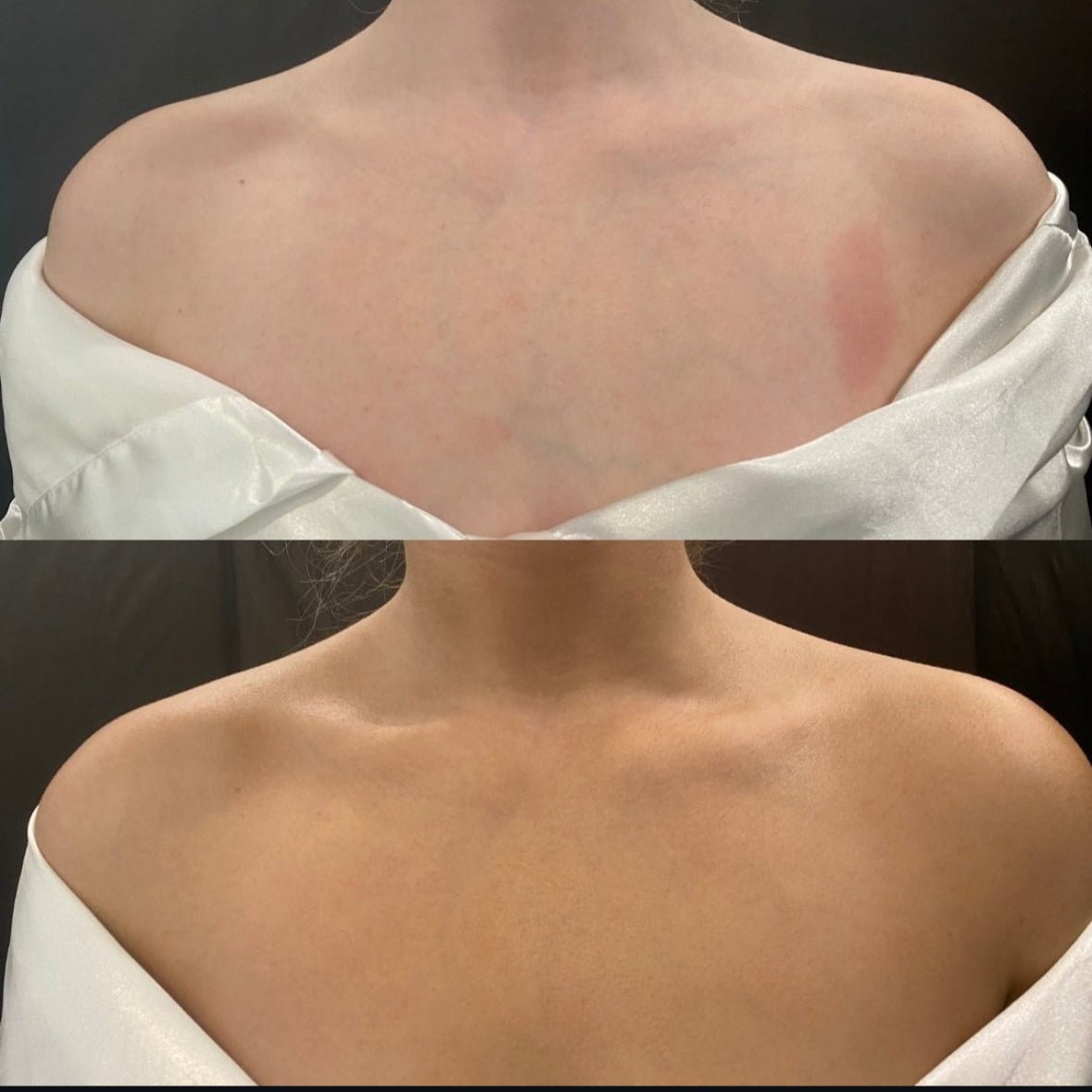 Spraytan - voordeel abonnement - Blossoms Beauty